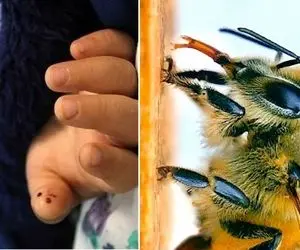 مرگ تلخ مستانه شاهپری دانش آموز خوزستانی بر اثر نیش زنبور