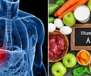 با این 6 مکمل و ویتامین کنترل کبد چرب تو مُشتت میاد؛ علائم گرید یک و روش بهبود بی قرص