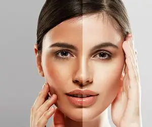 چگونه رنگ پوست خود را روشن تر کنیم؟!