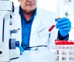 چگونه آزمایش خون را تفسیر کنیم؟