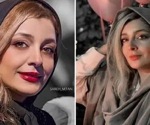 استایل زیادی گرونِ ساره بیات که انگاری طاقه پارچه رو درسته پوشیده؛ ژل تزریقید یا توپ!