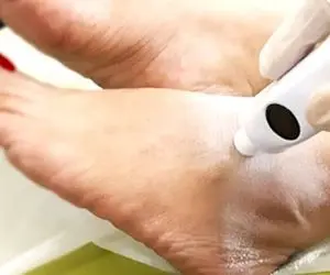 راهکارهای سفید کننده و روشن کننده قوزک پای تیره و سفت؛ تنها در یک هفته بیشترین تاثیر