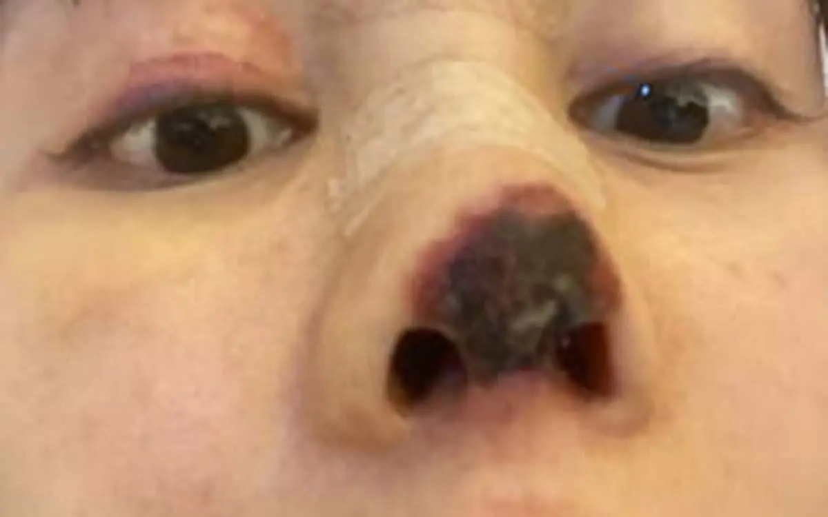 38914450-9227359-The_Chinese_actress_underwent_a_nose_job_involved_removing_her_c-a-15_1612520723814
