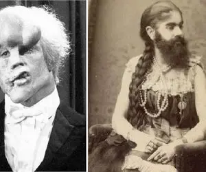 عجایب روزگار؛ انسان‌های عجیب الخلقه‌ای که از نقصهاشون پلی برای پیشرفت ساختند