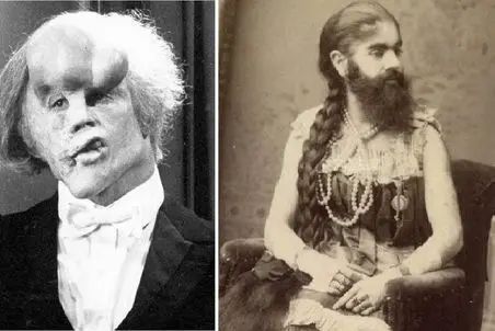 عجایب روزگار؛ انسان‌های عجیب الخلقه‌ای که از نقصهاشون پلی برای پیشرفت ساختند