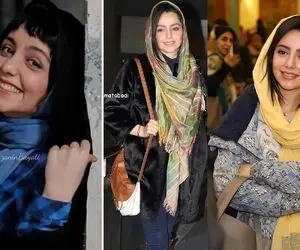 تغییر شگرف "نازنین بیاتی" بعد پولسازی؛ با زاویه فک و موی بنفش کُپ مینیون شد!