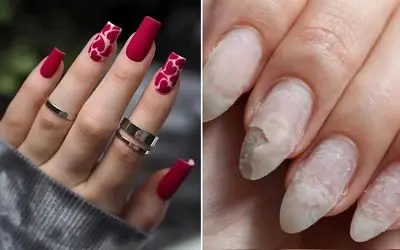 روش ضخیم کردن صدف ناخن و از بین بردن قارچ؛ تقویت موثر بعد از کاشت و ترمیم پشت هم