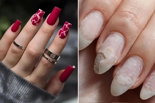 روش ضخیم کردن صدف ناخن و از بین بردن قارچ؛ تقویت موثر بعد از کاشت و ترمیم پشت هم