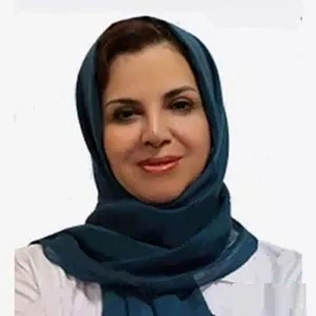 دکتران متخصص در درمان ریزش موی ارثی