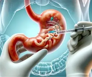 آشنایی با خدمات نوین کلینیک حکمت | کاهش وزن با بوتاکس