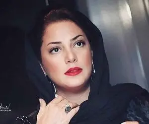 عکسی باور نکردنی از طناز طباطبایی قبل از عمل زیبایی