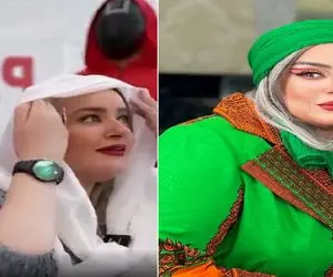 نعیمه نظام دوست و ربایش با بنز توسط اسکویید گیم / عمل غبغب و موهایی که رنگ دندون شد