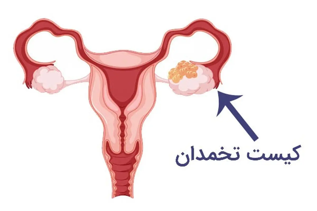 444