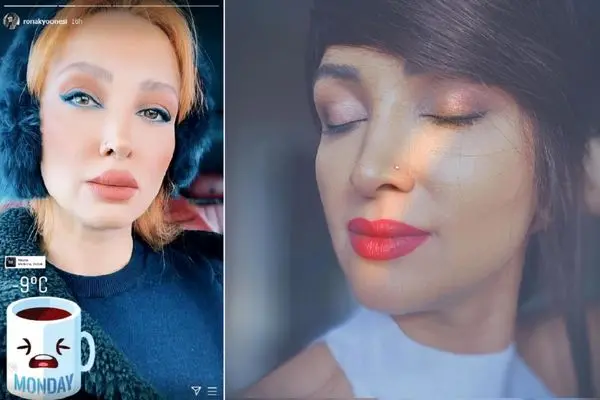 ronak yoonesi shayanewd