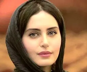 پست عجیب الناز شاکردوست بعد از کشیدن دندان