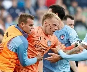 (عکس) دربی خونین استرالیا!