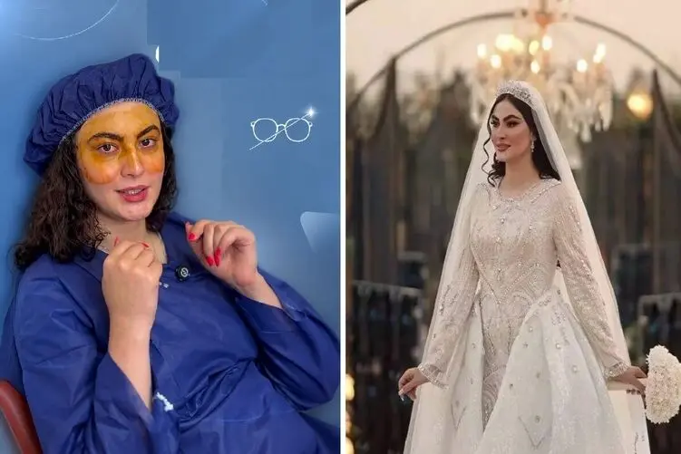 عینک برای مریم مومن هم به خاطره پیوست؛ مریم مومن در اتاق عمل