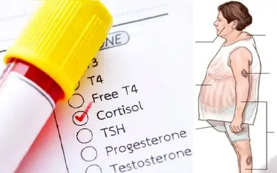 کورتیزول؛ از علم تا اینستاگرام/ هورمونی که این روزها همه درباره‌اش دروغ می‌گویند!
