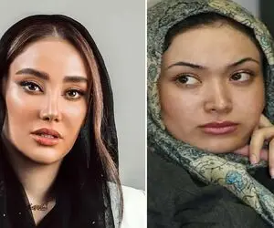 نیو فیس سازی بهاره افشاری بعد از ۱۴ سال/ بیتای فاصله ها یا زنی که دو چهره دارد؟!