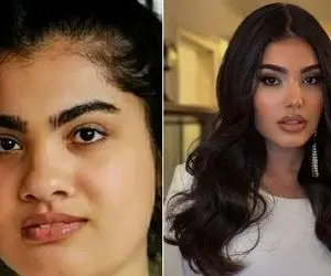 عمل بینی لیزگه کومرت در ترکیه / سوسن سریال خواهران و برادران قبلش قابل تشخیص نیست