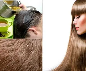 سفید های دوست نداشتنی؛ با این دمنوش های گیاهی خانگی از شر شوره سر و ریز مو خلاص شووو!