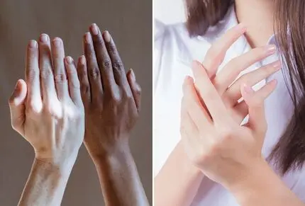 ماسک‌ های گیاهی و طبیعی روشن کننده پوست دست؛ در چند روز دستانی سفید و ظریف بسازید