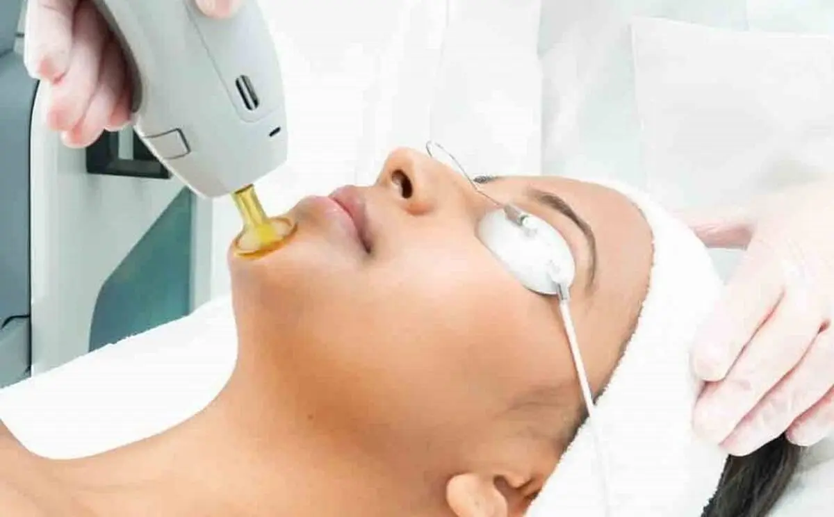 آیا لیزر موهای زائد موجب ابتلا به سرطان و نازایی می شود؟