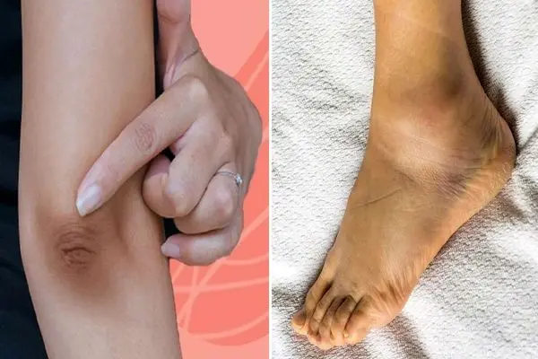 روش سفید کردن نواحی تیره بدن مثل قوزک پا، آرنج و زانو؛ حیف اینو بلند نباشی خیلی آسونه