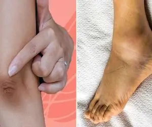 روش سفید کردن نواحی تیره بدن مثل قوزک پا، آرنج و زانو؛ حیف اینو بلند نباشی خیلی آسونه