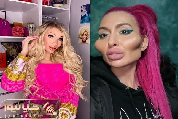 جراحی پلاستیک