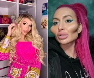 افراط مهیب این خانوما تو جراحی پلاستیک آدمو میهَنگونه؛ دیدن قبل و بعدشون کفاره میخواد!