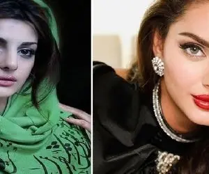 قبل و بعد مه لقا جابری / با این میزان عمل عباس آقا بقال هم میتونن مدلینگ بشن