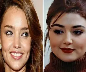 ترفند برای چال لپ درآووردن / یه بطری نوشابه میخوای تا بشه تو چال گونه ات غرق شد