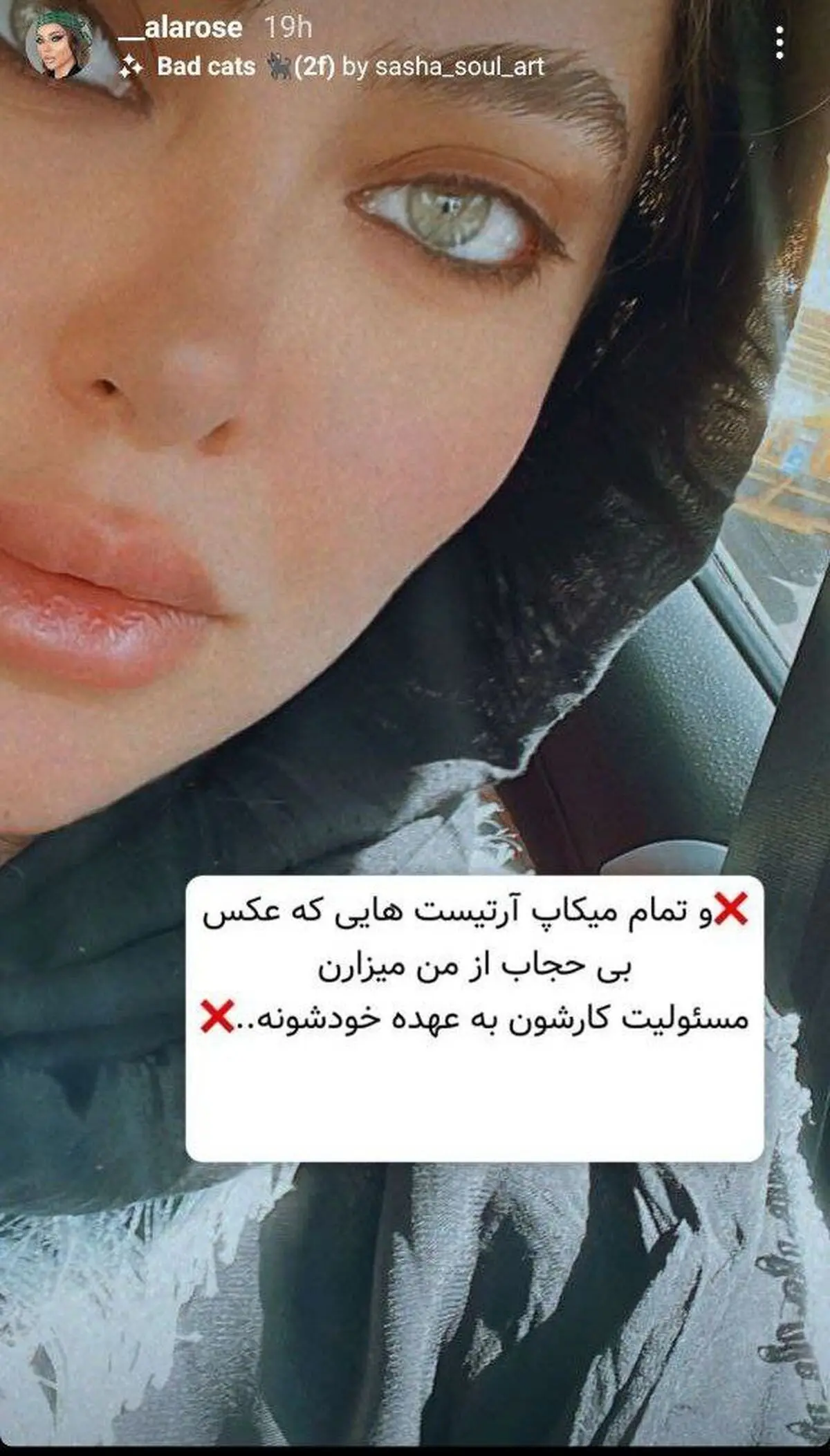 آلارز