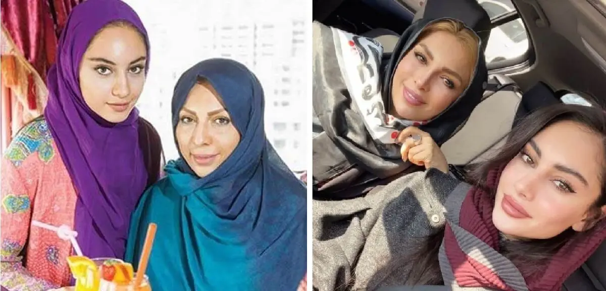 قبل و بعد مادر ترلان پروانه