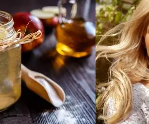 چرا باید از سرکه سیب استفاده کنیم؟ از رفع شوره تا کاهش وزن!