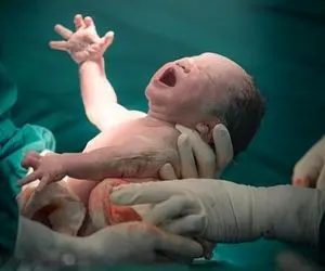 تولد عجیب یک نوزاد با دو دندان + عکس