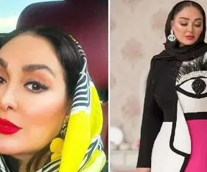 تغییر چهره عجیب الهام حمیدی بی آرایش که بالاخره بینیشو عمل کرد؛ بدلش چه کپشه!
