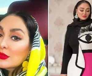 تغییر چهره عجیب الهام حمیدی بی آرایش که بالاخره بینیشو عمل کرد؛ بدلش چه کپشه!