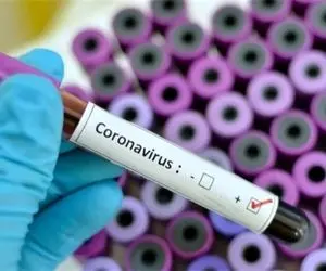 تاکید سازمان لیگ فوتبال ایران؛ دوباره تست کرونا بگیرید  