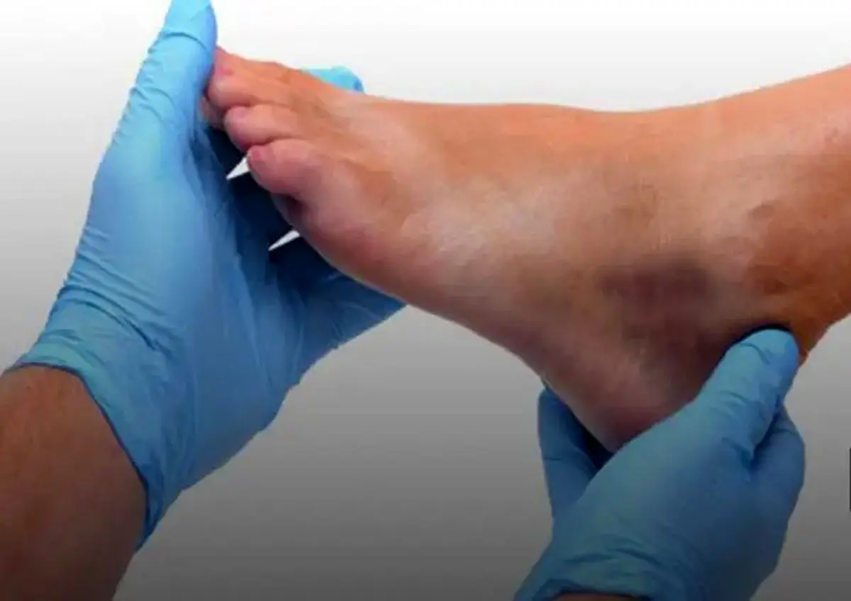 روش سفید کردن نواحی تیره بدن مثل قوزک پا، آرنج و زانو؛ حیف اینو بلند نباشی خیلی آسونه