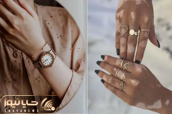 ساعت مچی زنانه