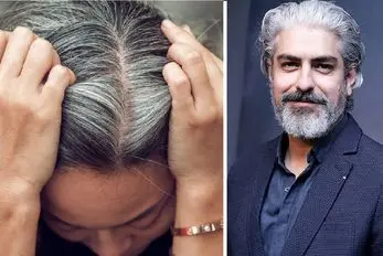 آلودگی هوا فقط ریه‌ها را ضعیف نمی‌کند، موها را هم سفید می‌کند!