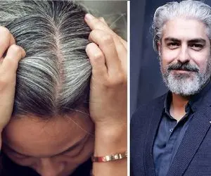 آلودگی هوا فقط ریه‌ها را ضعیف نمی‌کند، موها را هم سفید می‌کند!