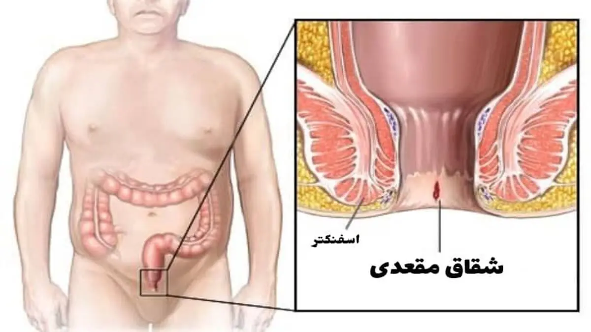 image_7c8f31f57081e07a6b6156ea9ff2ebdc3900eadd