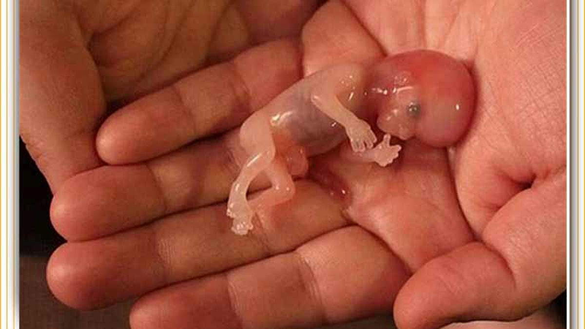 سقط-جنین-چیه؟