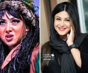 بیوگرافی آزاده صمدی و فیلری که از چونه‌اش چکید / عاطفه وحشی حالا ظاهری مدرن دارد