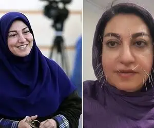 تغییر چهره مجری سرشناس بعد از خداحافظی با تلویزیون+ عکس