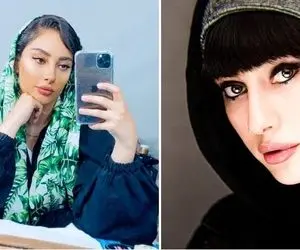 زیبا شدن ترلان پروانه و ماجرای عمل چشم گربه‌ای!