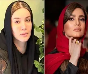 این عکس قبل عمل متین ستوده رو حتی خودشم نداره؛ خانوم ببخشیندا ولی شما شفا گرفتی